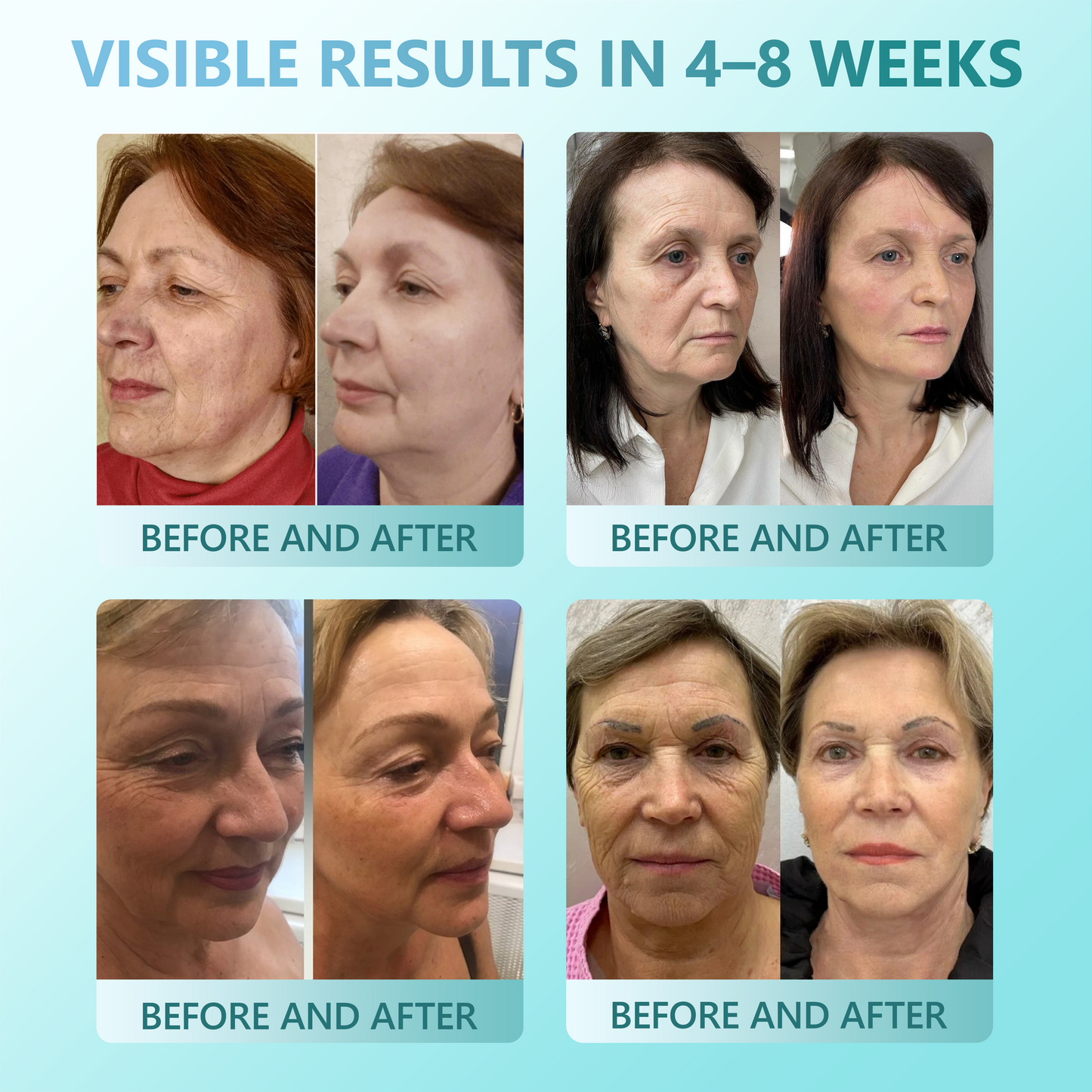 𝐑𝐞𝐜𝐨𝐦𝐦𝐞𝐧𝐝𝐞𝐝 𝐛𝐲 𝐔𝐒 𝐃𝐞𝐫𝐦𝐚𝐭𝐨𝐥𝐨𝐠𝐢𝐬𝐭𝐬✨𝓥𝒊𝒕𝙖𝙡𝒊𝙨𝙮𝙨® 𝑷𝘿𝑹𝐍 𝑨𝒏𝒕𝒊-𝒂𝒈𝒆 & 𝑭𝒊𝒓𝒎𝒊𝒏𝒈 𝑺𝒆𝒓𝒖𝒎 𝑺𝒕𝒊𝒄𝒌✨